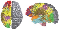 IBM kartlägger människans hjärna för att skapa avancerade hjärnchip